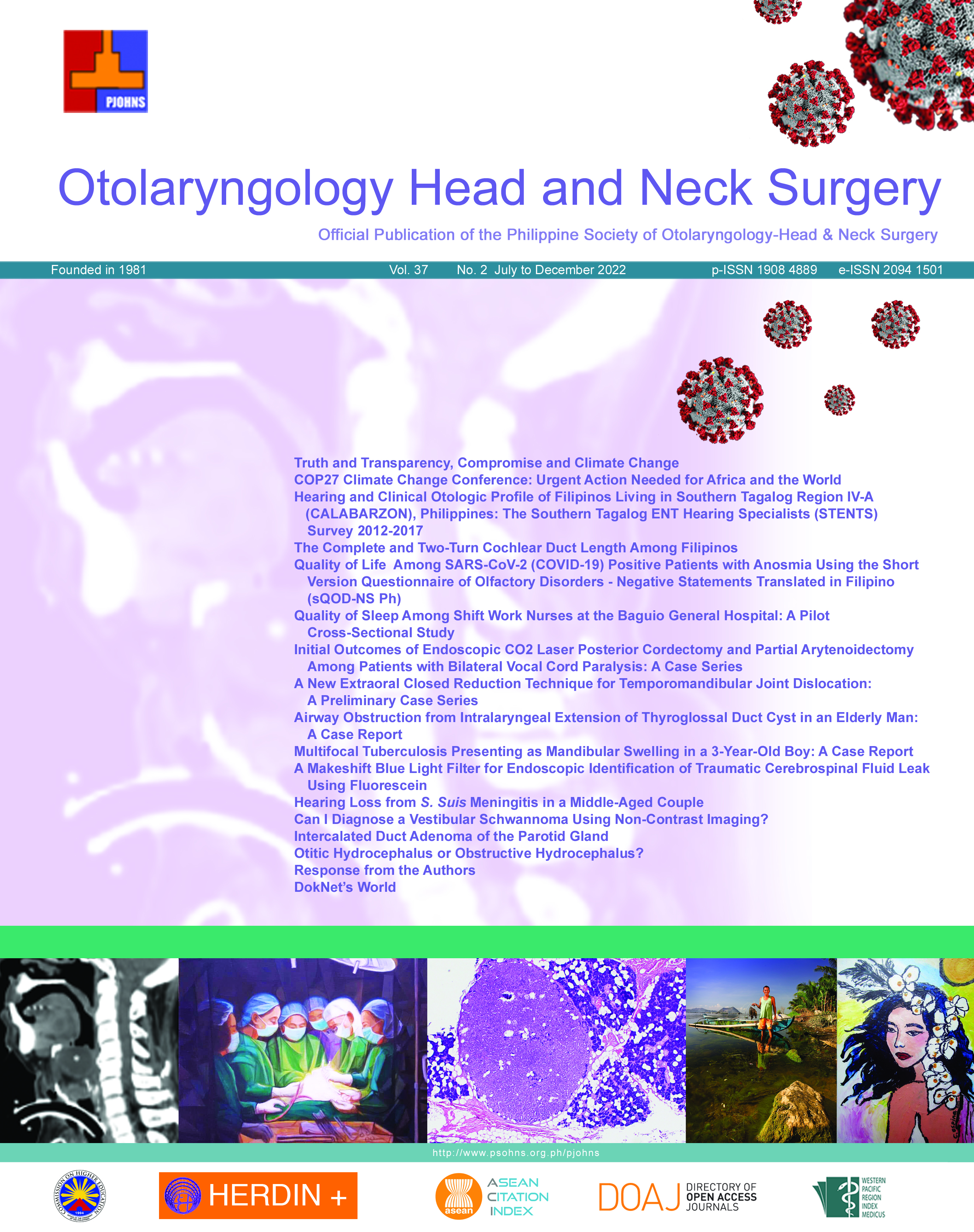 					View Vol. 37 No. 2 (2022): Philippine Journal of Otolaryngology Head and Neck Surgery
				