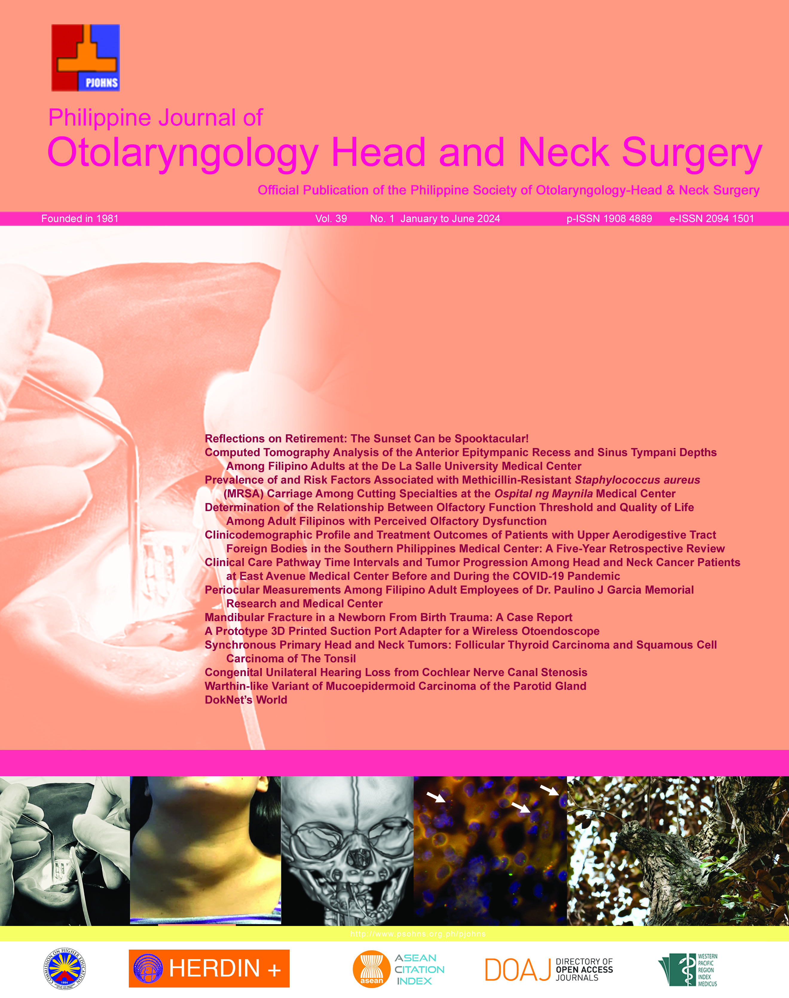 					View Vol. 39 No. 1 (2024): Philippine Journal of Otolaryngology Head and Neck Surgery
				