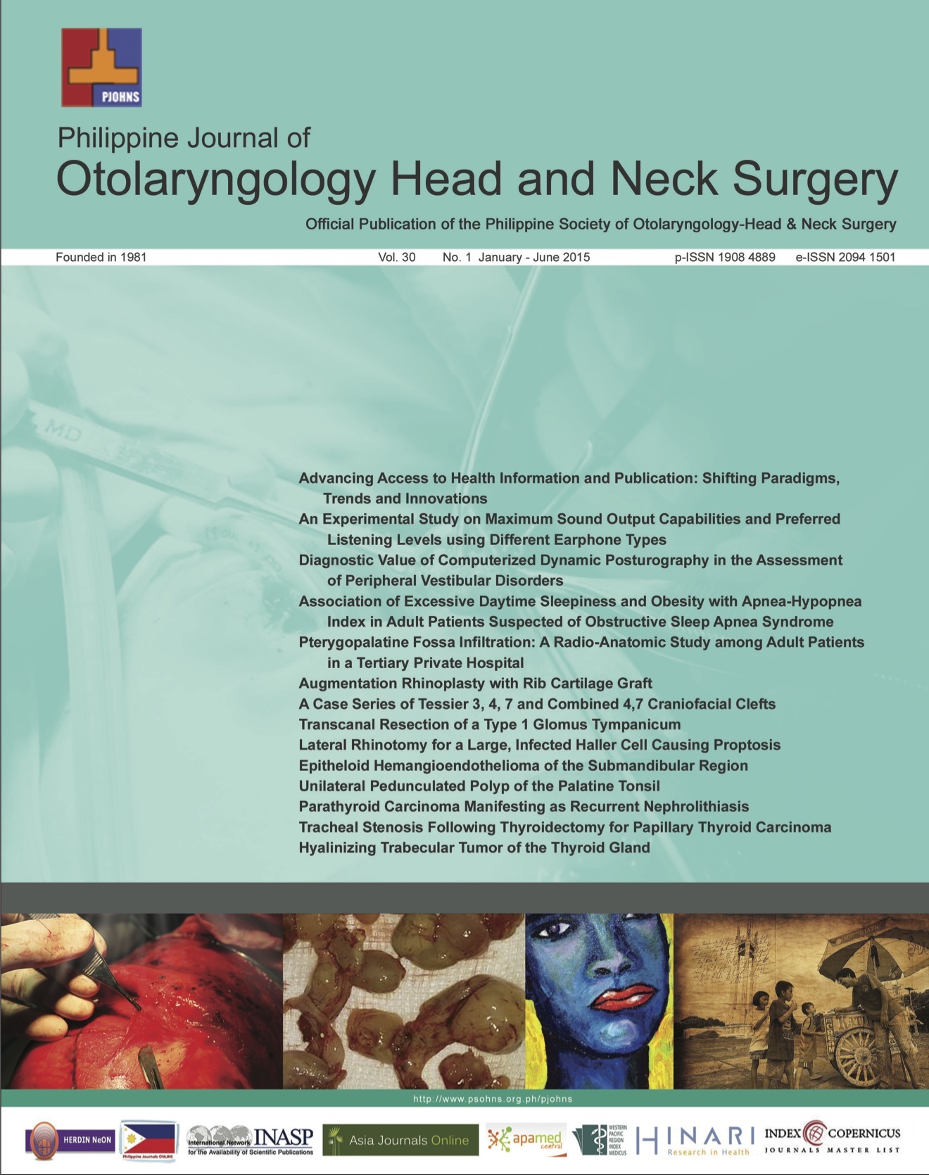 					View Vol. 30 No. 1 (2015): Philippine Journal of Otolaryngology-Head and Neck Surgery
				